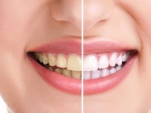 Кои плодове избелват зъбите по-добре от паста
