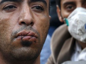  Бежанци си зашиха устата публично (СНИМКИ 18+)