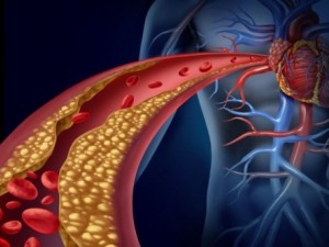 „Добрият” холестерол увеличава риска от инфаркт