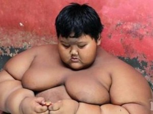 Най-дебелото дете в света тежи 192 кг, а е само на 10 години!