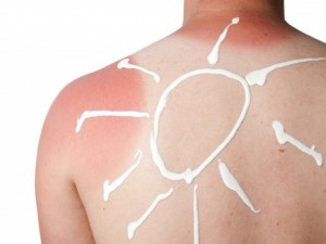 
13 бързи трика при слънчево изгаряне

