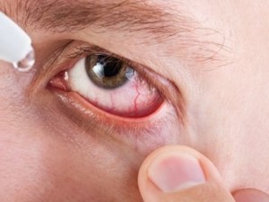 Първа помощ при очен кръвоизлив