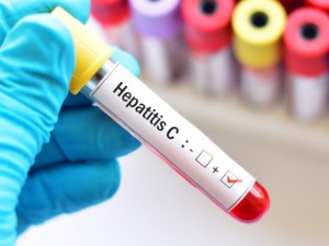 77 000 българи болни от хепатит С, 90% не знаят
 