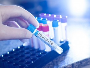 Здравноосигурените не трябвало да плащат за тестове за коронавирус
