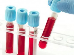Кръвен тест лови рака 4 години преди появата му
