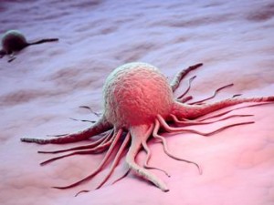4 вида рак се предават по наследство 
