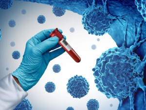 
	Кръвен тест открива 50 вида рак

